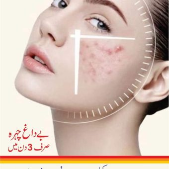 Acne Cream