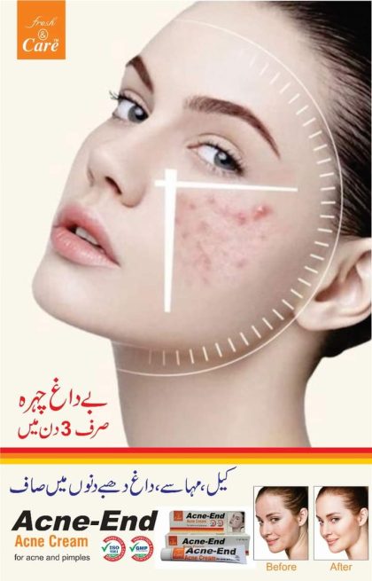 Acne Cream